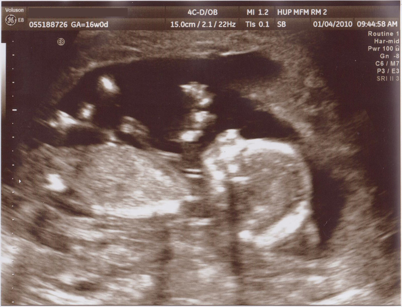 2010 16 week ultrasound